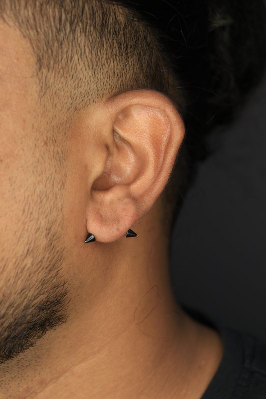 Transverse lobe piercing with black spike ends