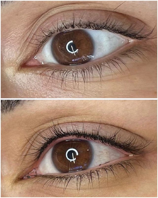 Eyeliner pigmentation before and after result