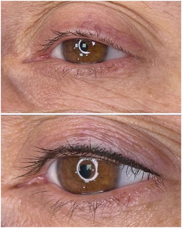 Permanent eyeliner pigmentation before and after