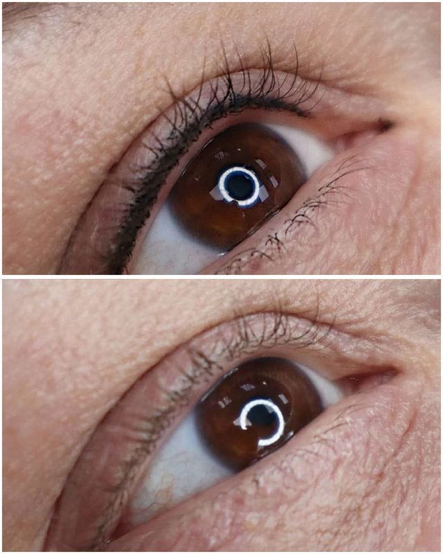 Lash line eyeliner pigmentation before and after